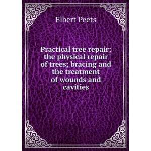   bracing and the treatment of wounds and cavities Elbert Peets Books